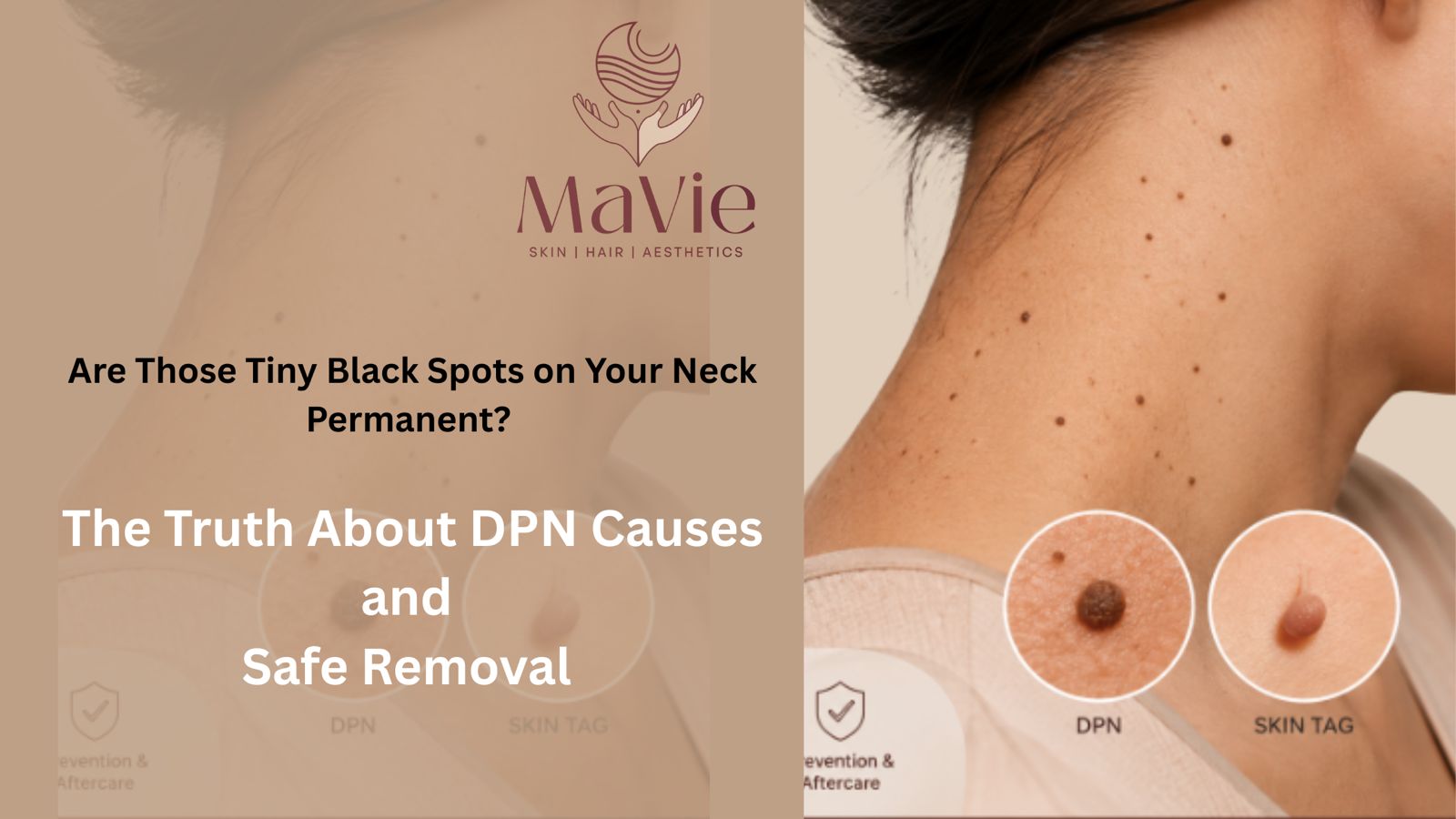 Read more about the article The DPN &Skin Tag Removal Guide